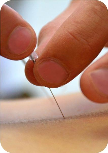 chiropractic assistance for nerve impingement