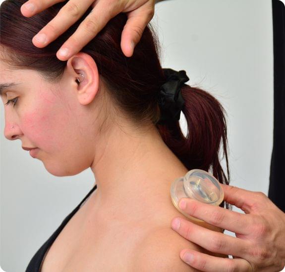 A chiropractitioner displaying Dynamic Cupping